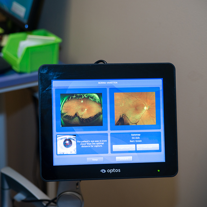 A medical screen shows orange blacklight photos of an eye on a blue screen.