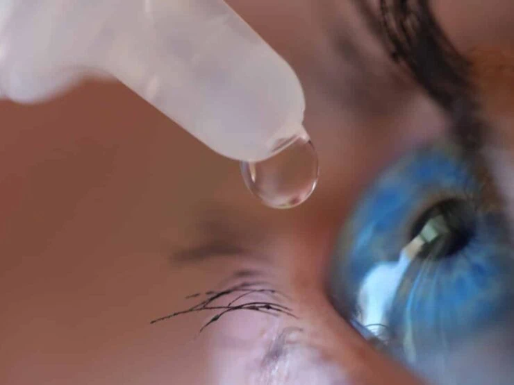 Woman applying eye drops to eye closeup